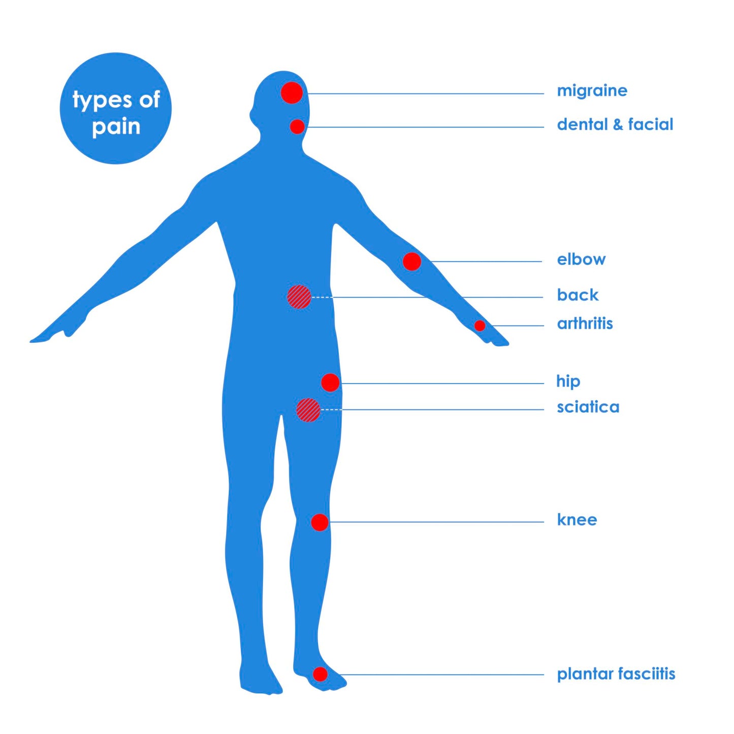 TensCare Perfect TENS Pain Relief Machine